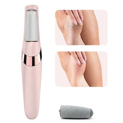 🌸 Soft & Smooth Heels in Just 5 Minutes — No Salon Needed!